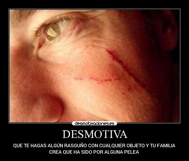 DESMOTIVA -