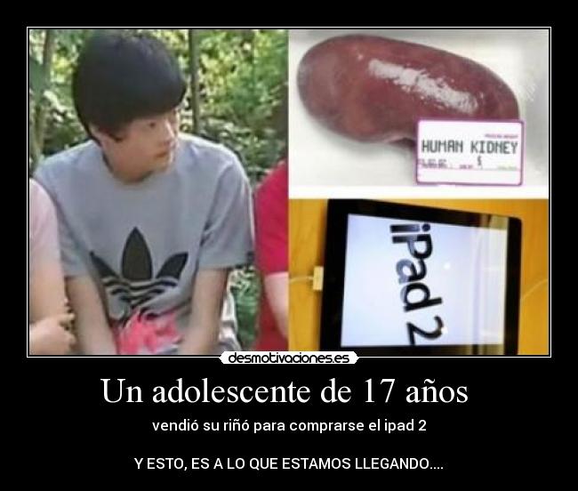 Un adolescente de 17 años  - vendió su riñó para comprarse el ipad 2

Y ESTO, ES A LO QUE ESTAMOS LLEGANDO....