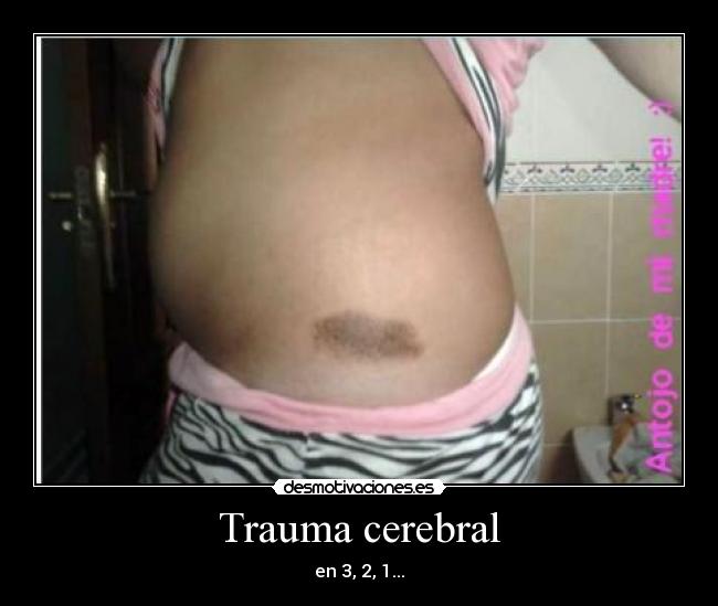 Trauma cerebral - en 3, 2, 1...