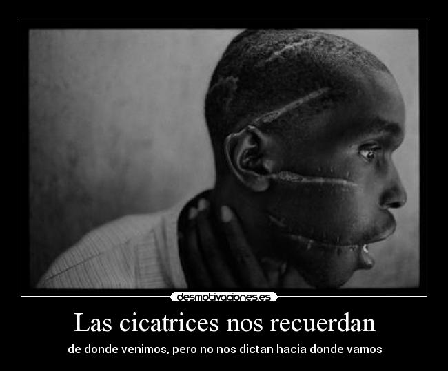 Las cicatrices nos recuerdan - 