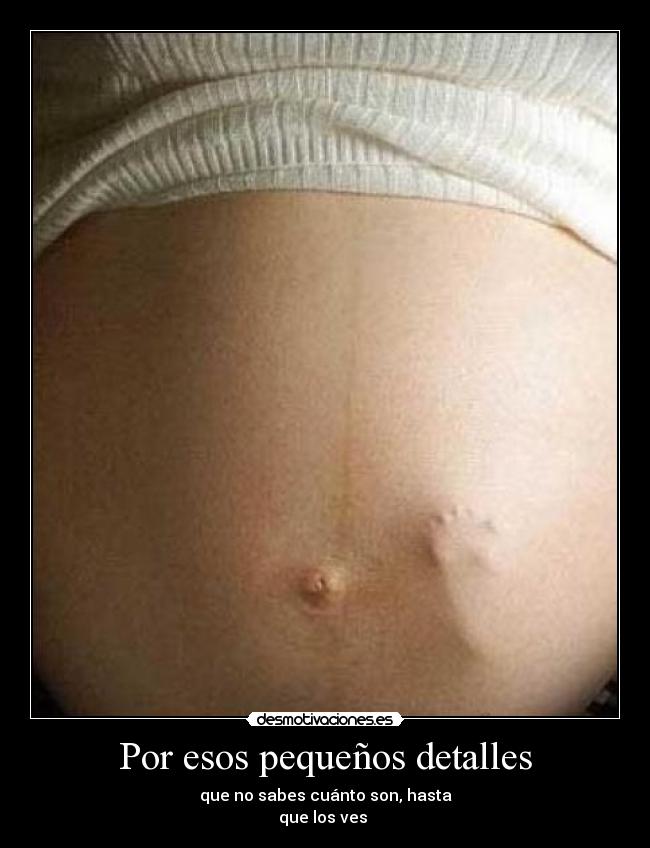 Por esos pequeños detalles -