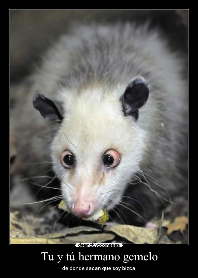Tu y tú hermano gemelo - de donde sacan que soy bizca