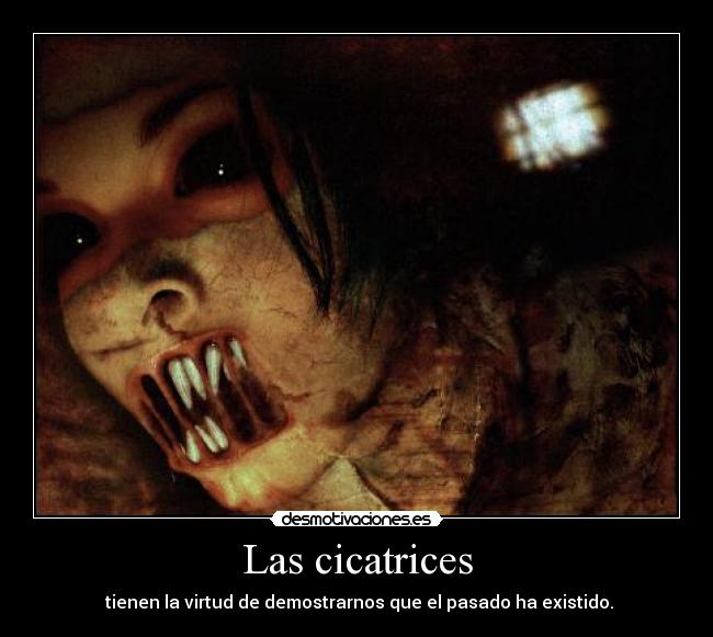 Las cicatrices -