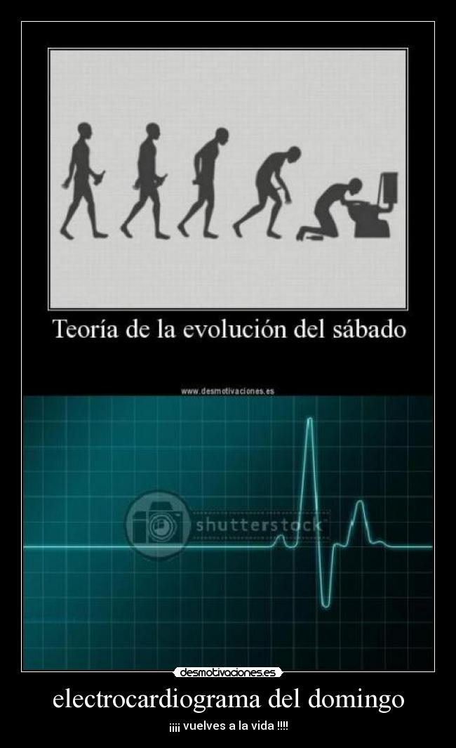 electrocardiograma del domingo - ¡¡¡¡ vuelves a la vida !!!!