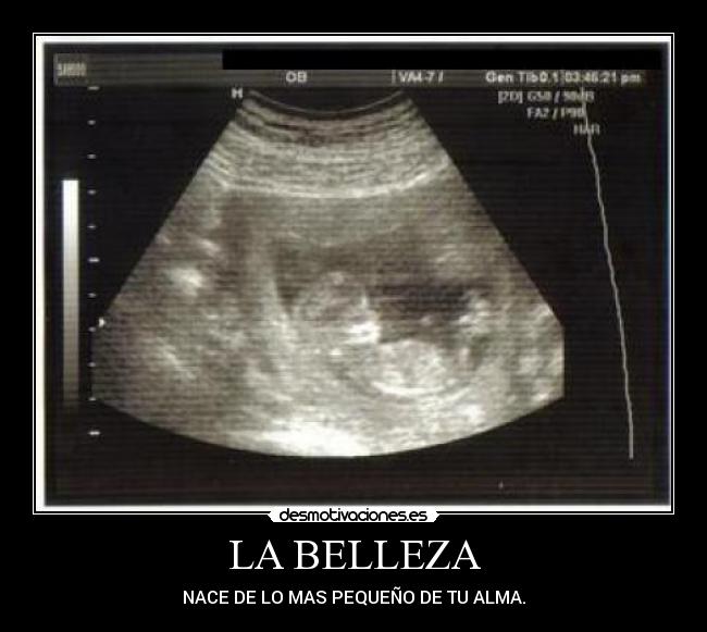 LA BELLEZA - 