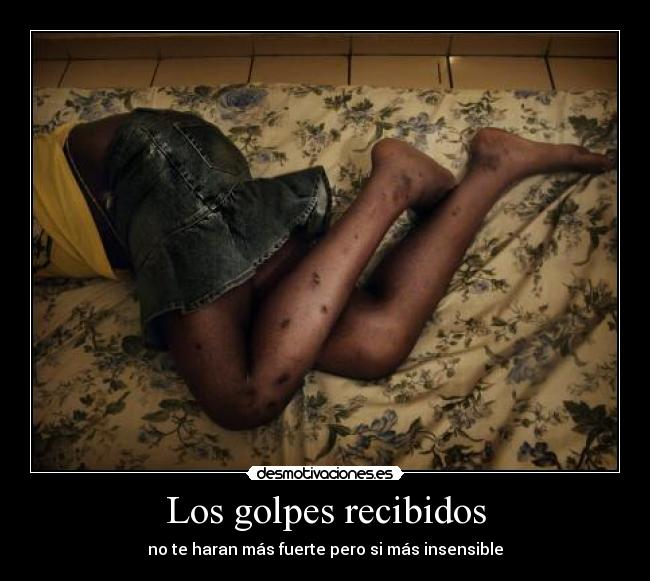 Los golpes recibidos - 