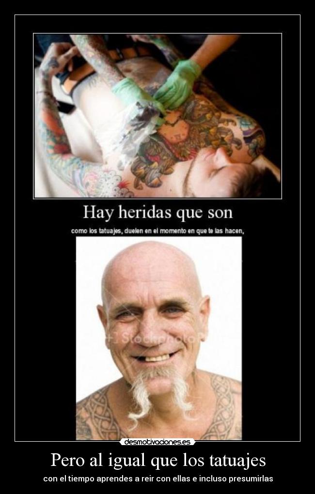 Pero al igual que los tatuajes - con el tiempo aprendes a reir con ellas e incluso presumirlas