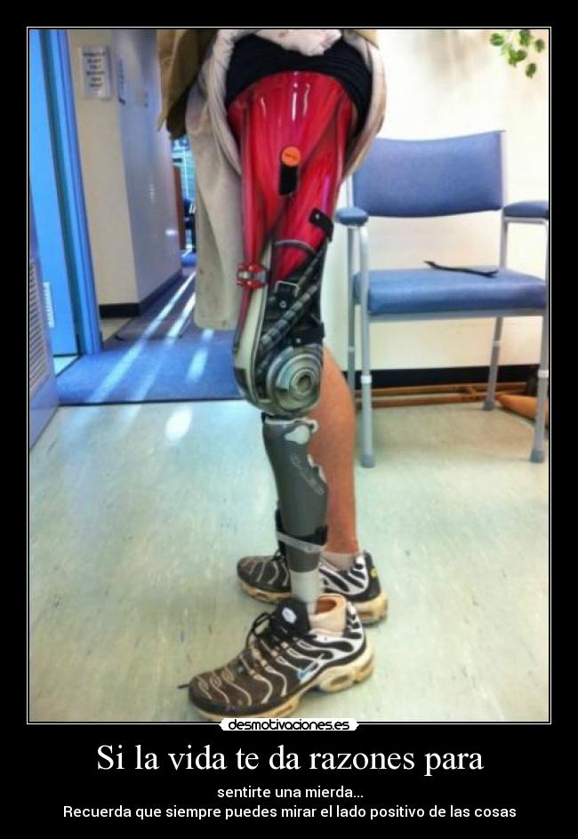Si la vida te da razones para - sentirte una mierda...
Recuerda que siempre puedes mirar el lado positivo de las cosas