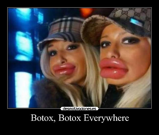 Botox, Botox Everywhere -     