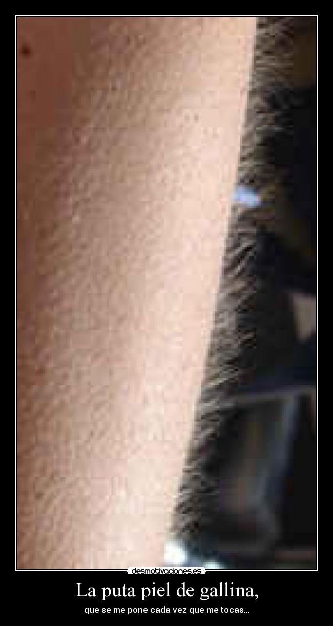 La puta piel de gallina, - que se me pone cada vez que me tocas...