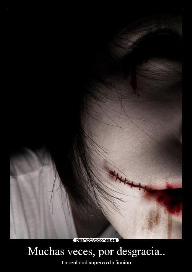 Muchas veces, por desgracia.. - 