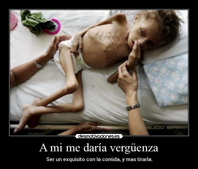 A mi me daría vergüenza -