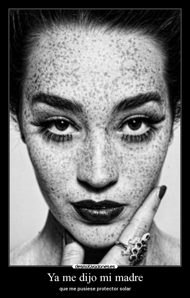 Ya me dijo mi madre - que me pusiese protector solar