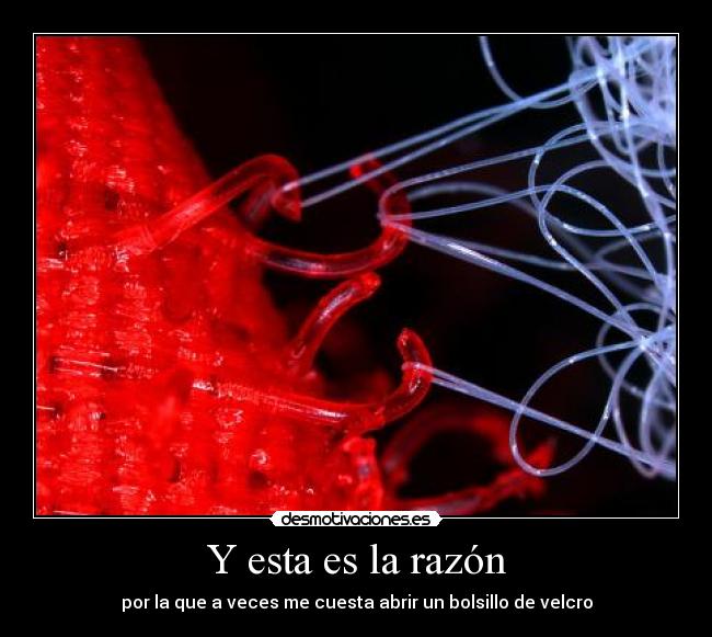 Y esta es la razón - por la que a veces me cuesta abrir un bolsillo de velcro