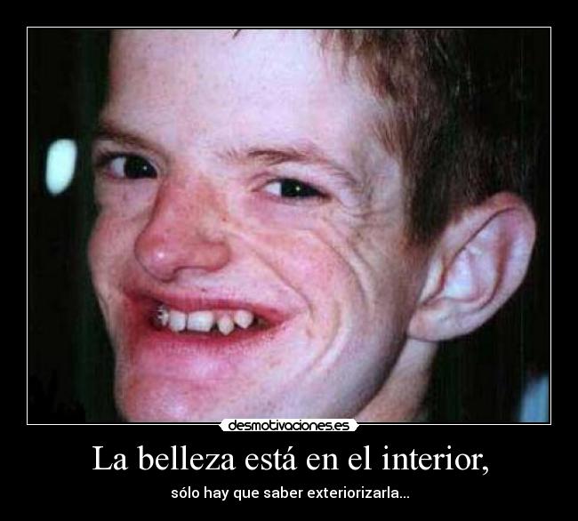 La belleza está en el interior, - 