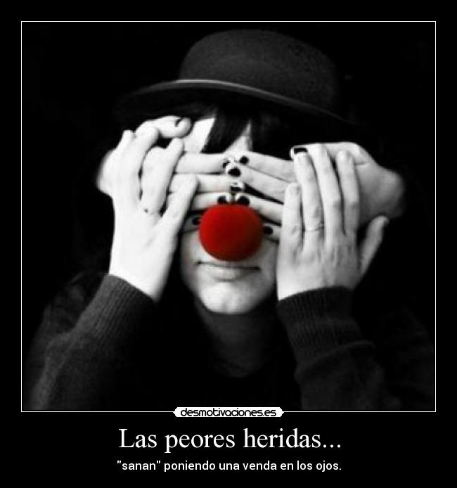 Las peores heridas... - 