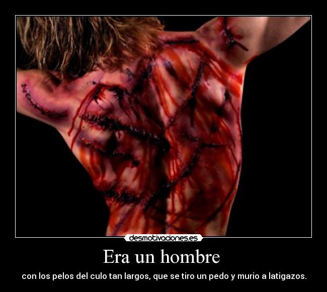 Era un hombre - con los pelos del culo tan largos, que se tiro un pedo y murio a latigazos.