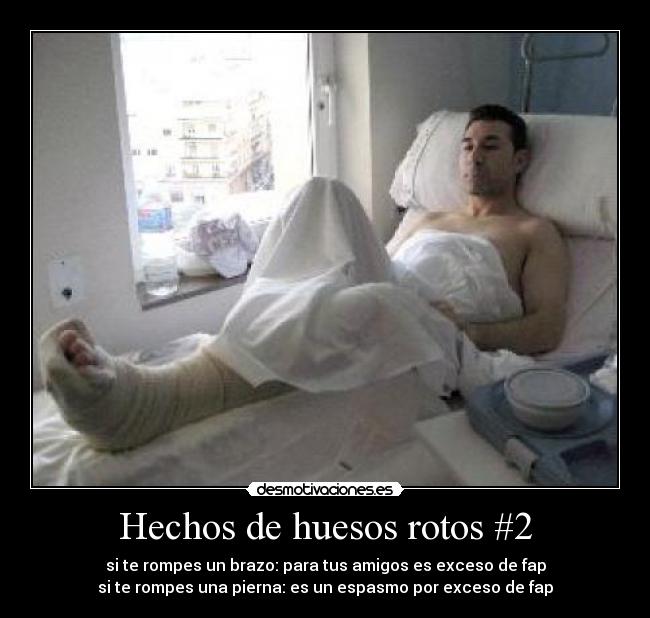 Hechos de huesos rotos #2 -
