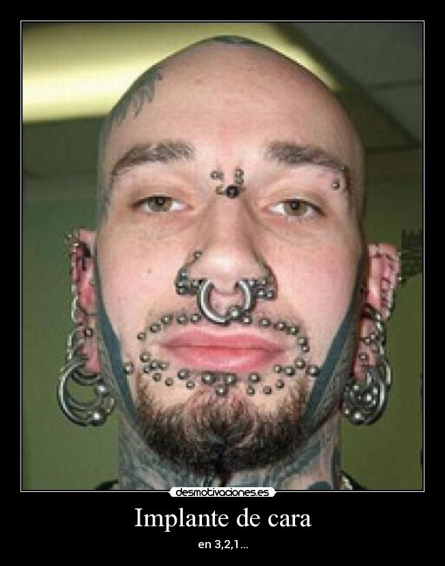 Implante de cara -
