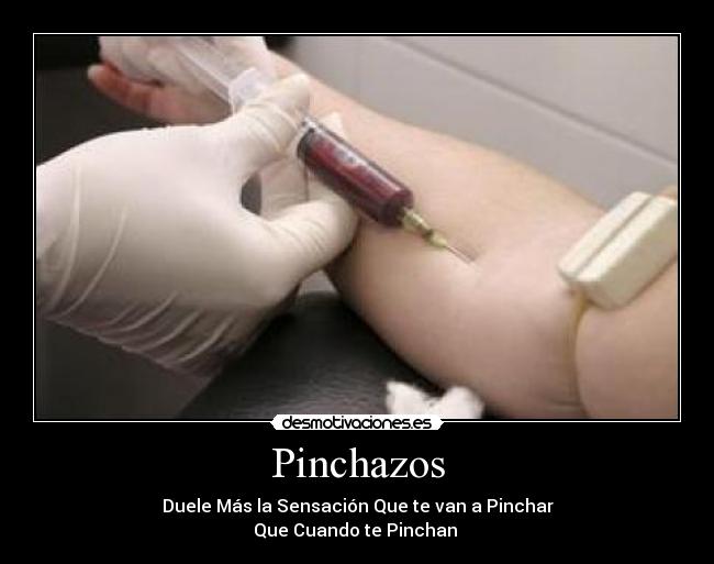 Pinchazos -