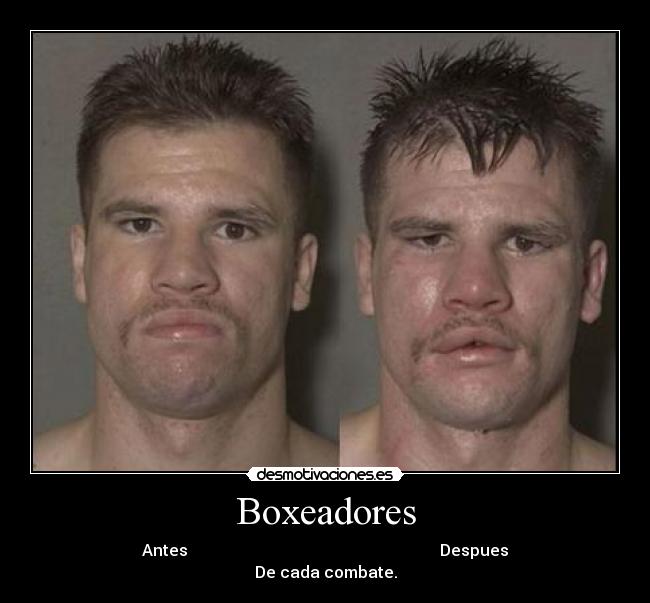 Boxeadores - Antes Despues
De cada combate.