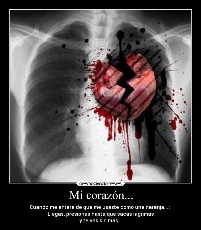Mi corazón... -