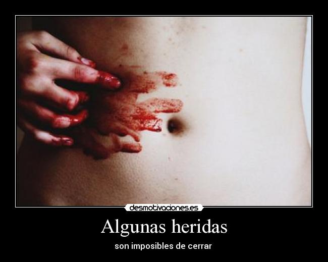 Algunas heridas - 