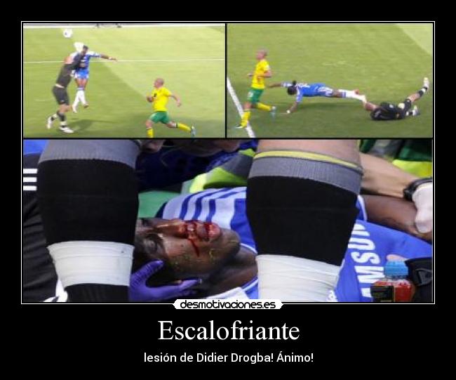Escalofriante - lesión de Didier Drogba! Ánimo!