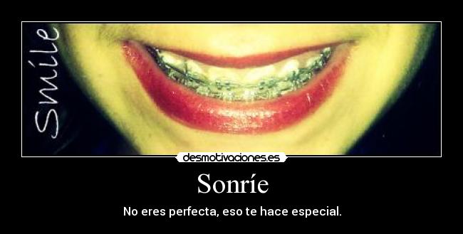 Sonríe - No eres perfecta, eso te hace especial.