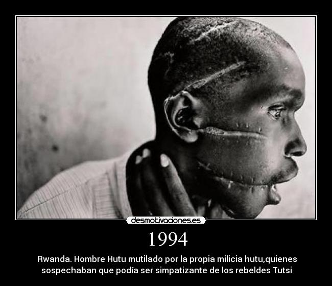 1994 - Rwanda. Hombre Hutu mutilado por la propia milicia hutu,quienes
sospechaban que podía ser simpatizante de los rebeldes Tutsi