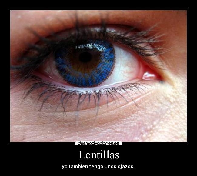 Lentillas - yo tambien tengo unos ojazos .