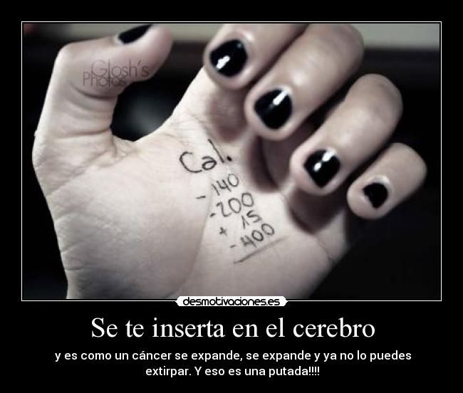Se te inserta en el cerebro - 
