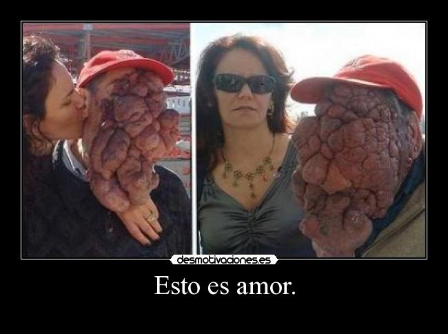 Esto es amor. - 