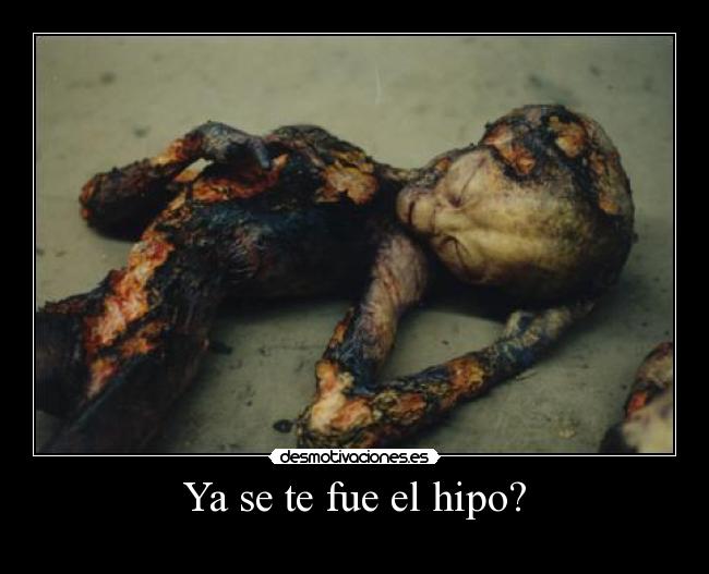 Ya se te fue el hipo? - 