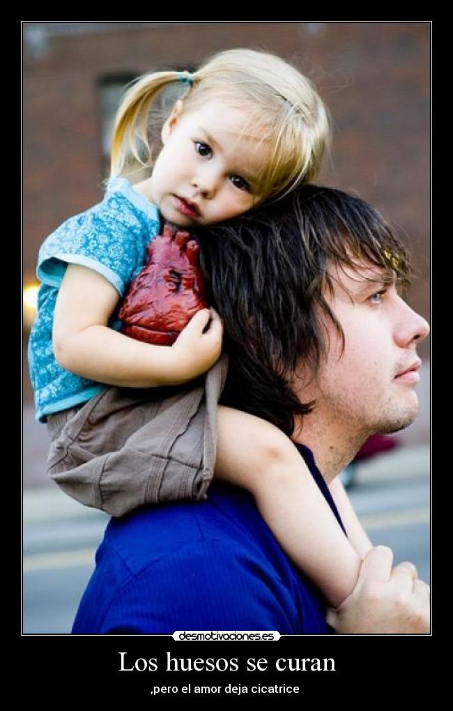 Los huesos se curan - 