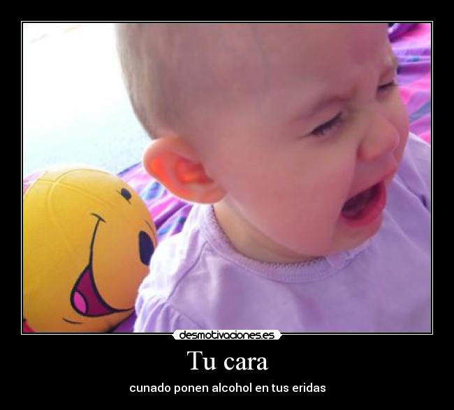 Tu cara - cunado ponen alcohol en tus eridas