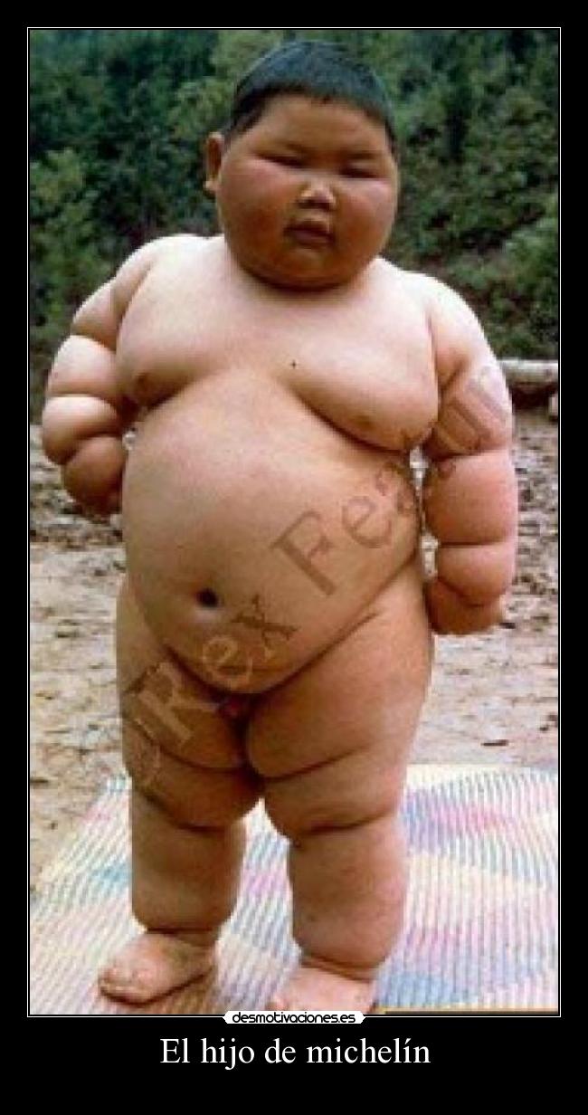 El hijo de michelín -