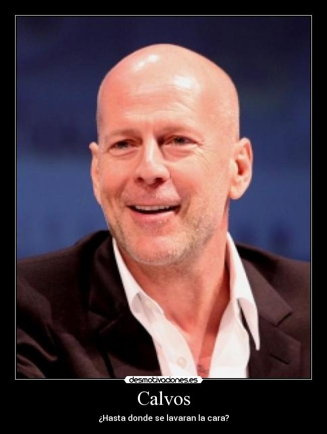 Calvos - ¿Hasta donde se lavaran la cara?