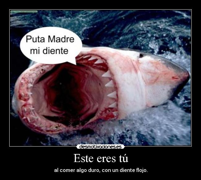 carteles este eres tu comer algo duro con diente flojo desmotivaciones