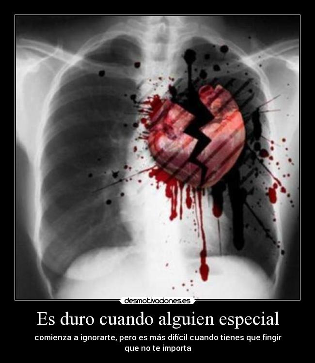 Es duro cuando alguien especial - 