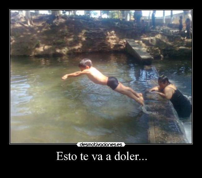 Esto te va a doler... - 