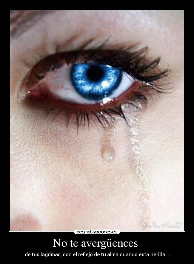 No te avergüences - de tus lagrimas, son el reflejo de tu alma cuando esta herida ...
