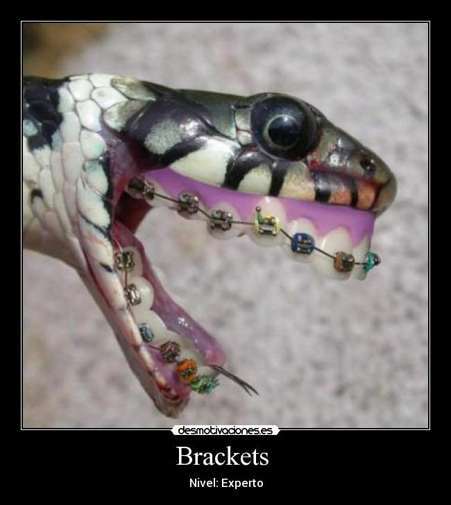 Brackets - Nivel: Experto