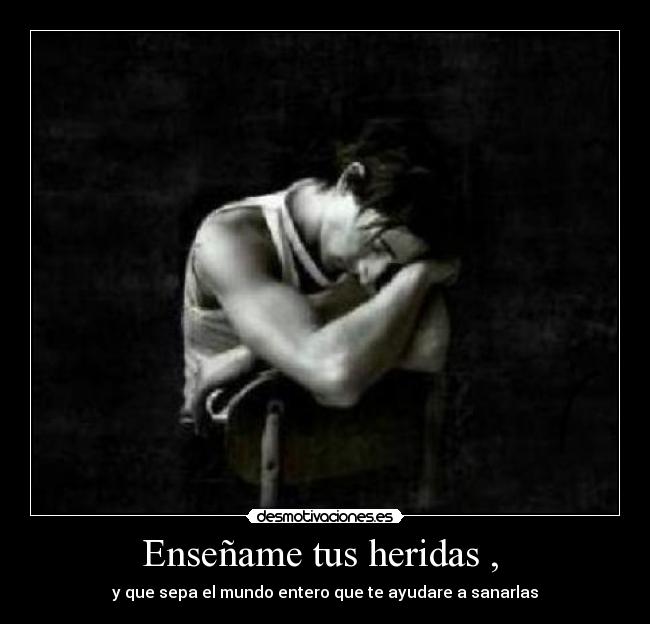 Enseñame tus heridas , - y que sepa el mundo entero que te ayudare a sanarlas