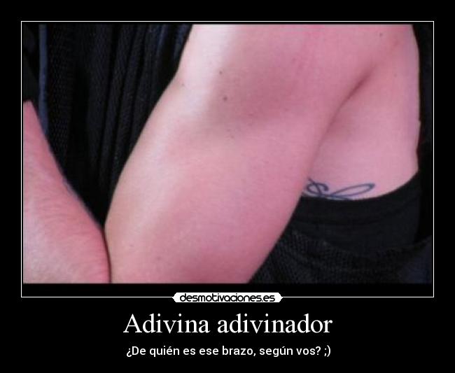 Adivina adivinador - ¿De quién es ese brazo, según vos? ;)