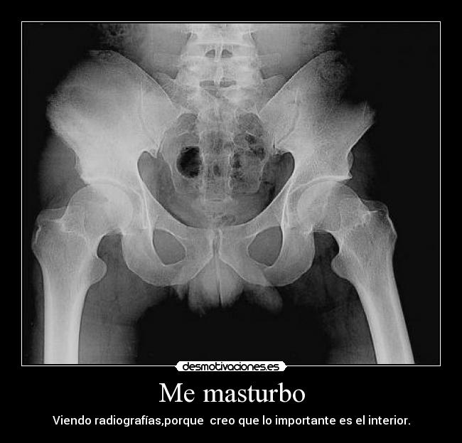 Me masturbo - Viendo radiografías,porque creo que lo importante es el interior.