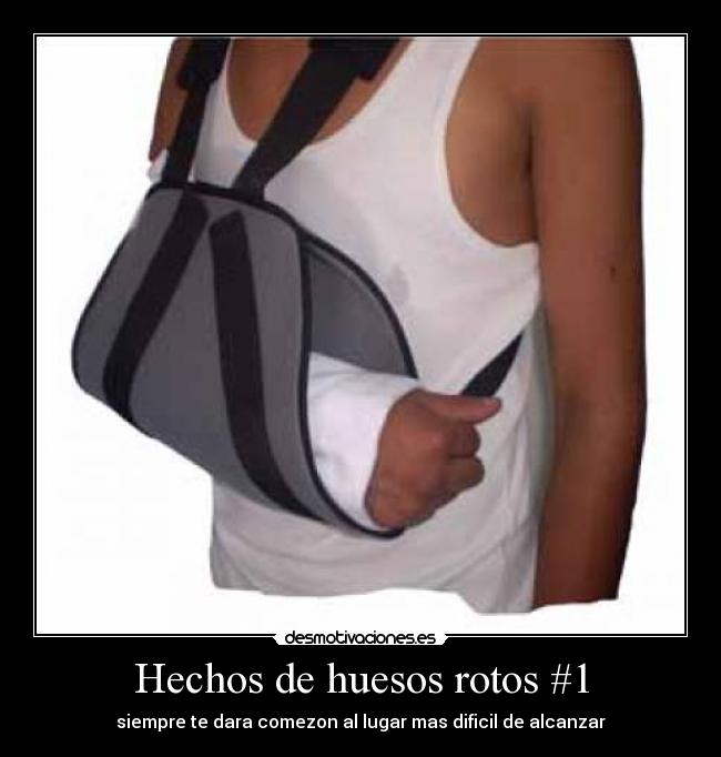 Hechos de huesos rotos #1 - 