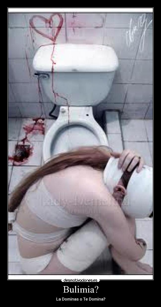Bulimia? -