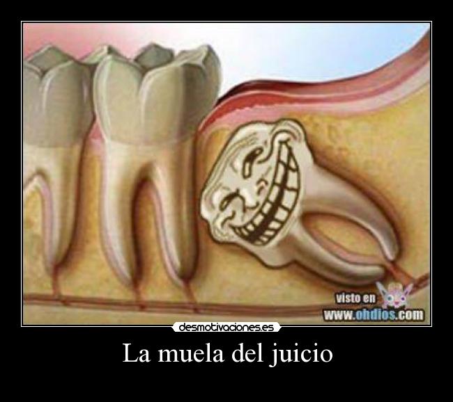 La muela del juicio -