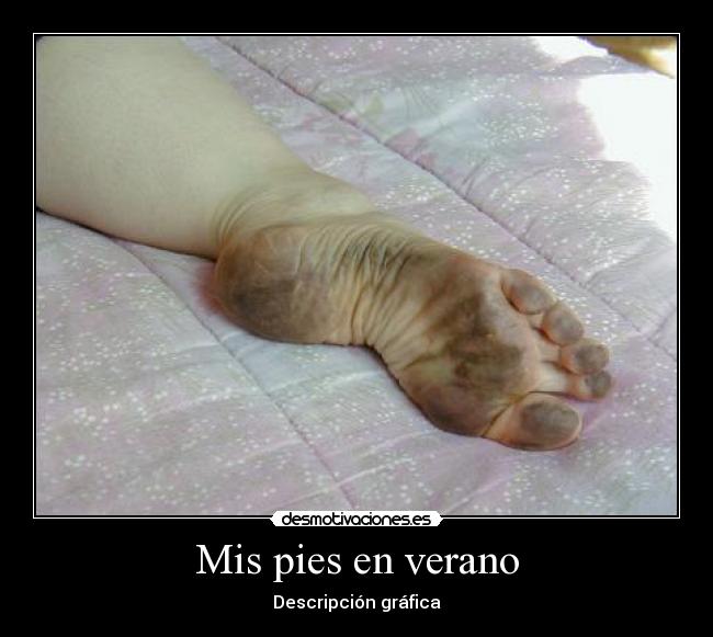 Mis pies en verano -